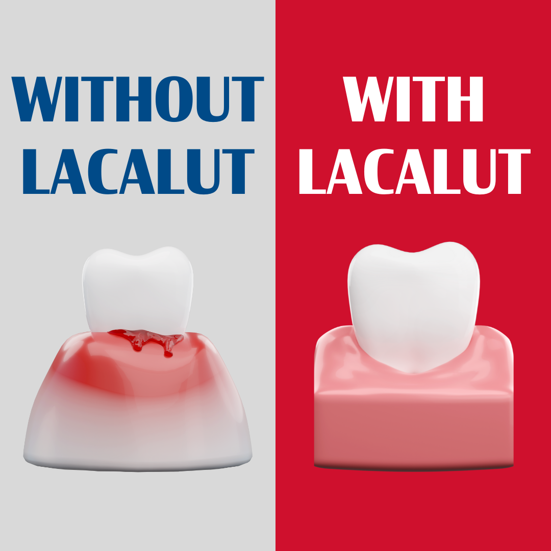 LACALUT® Aktiv 10ml Travel Size