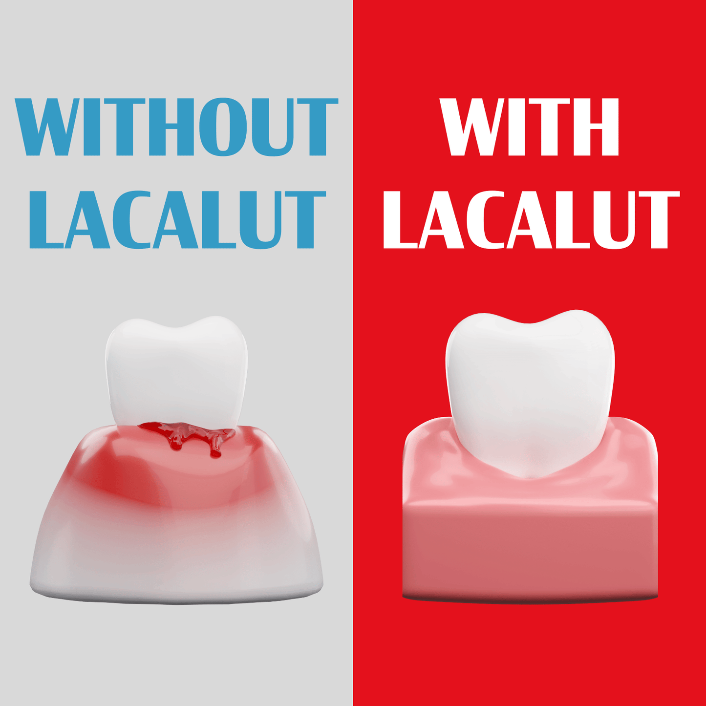 3 x LACALUT® Aktiv 75ml With 1 Bonus Travel Size Tube