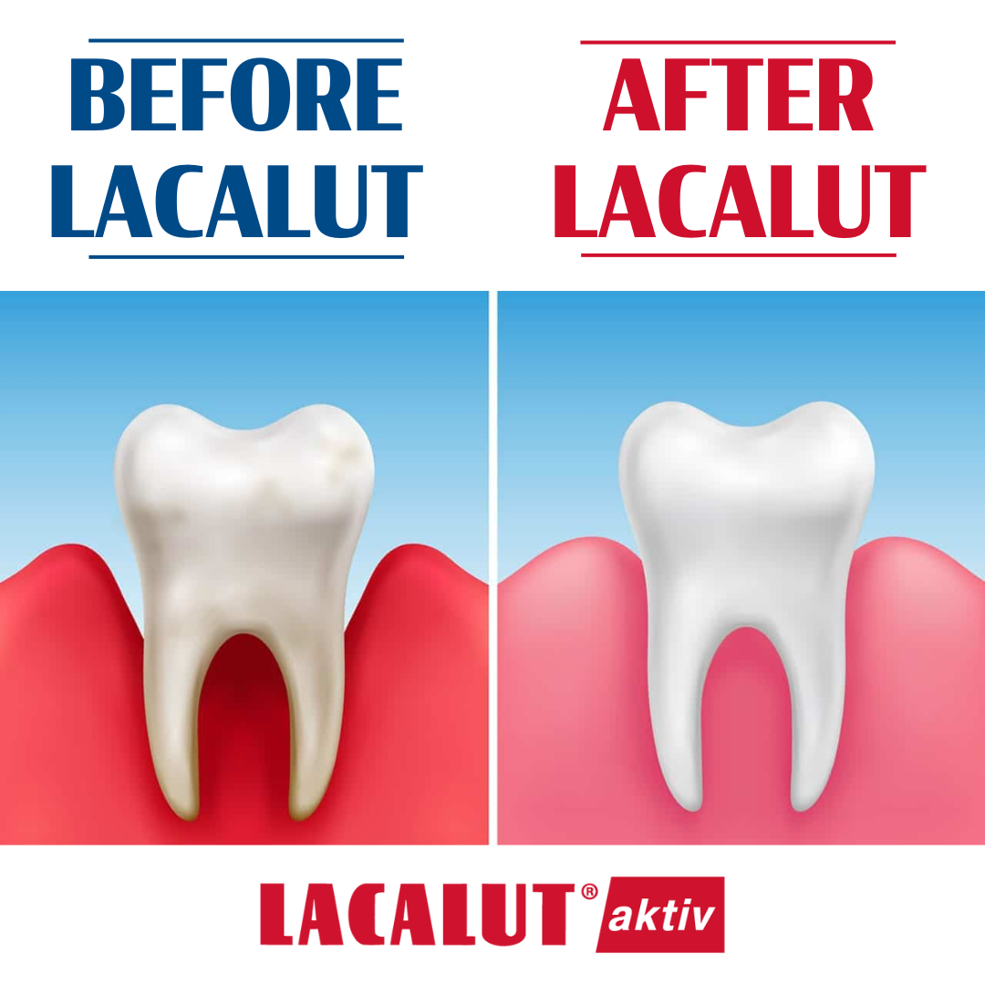 LACALUT® AKTIV 2-Part Bundle: Gingivitis Toothpaste, Mouthwash, & Toothbrush Bundle For Gum Disease (Copy) (view 11)