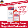 Advanced Gum Care Mouthwash | Long-Lasting Fresh Clean | LACALUT® AKTIV 300ml