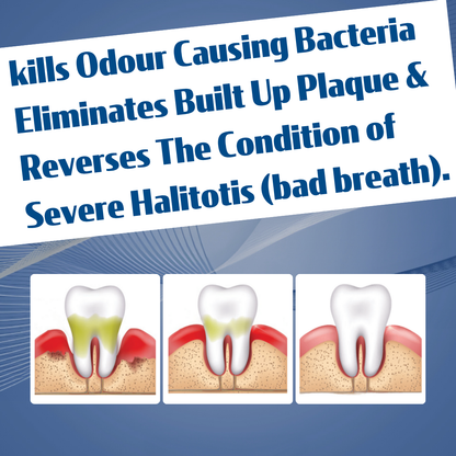 LACALUT® FLORA - Halitosis / Bad Breath Mouthwash - 2 x 300ml