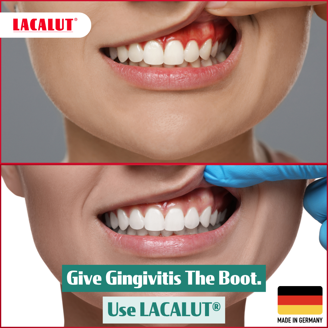 LACALUT® AKTIV HERBAL Gingivitis Toothpaste - 3 x 75ml