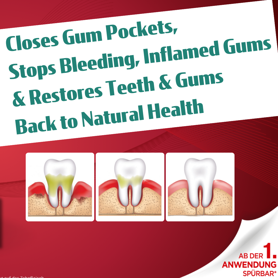 LACALUT® AKTIV HERBAL Gingivitis Toothpaste - 3 x 75ml